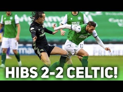 Celtic drop points AGAIN! – Hibs 2-2 Celtic – Match Reaction!