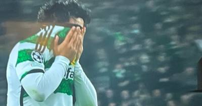 Reo Hatate in Celtic injury scare as midfield star leaves pitch in tears vs Atletico Madrid inside 5 minutes
