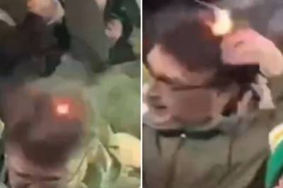 Celtic fan’s head set on fire amid ultras’ pyro display