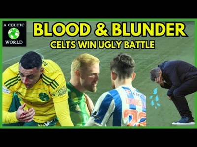 Blood & Blunder – Celts Win Ugly Battle
