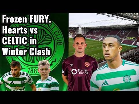 EPIC ENCOUNTER: Hearts vs Celtic Cold November Matchup Preview”
