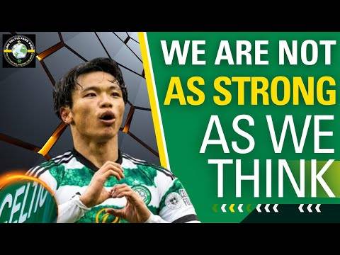 Khun Thigh STRAIN Before Celtic V Dundee UTD