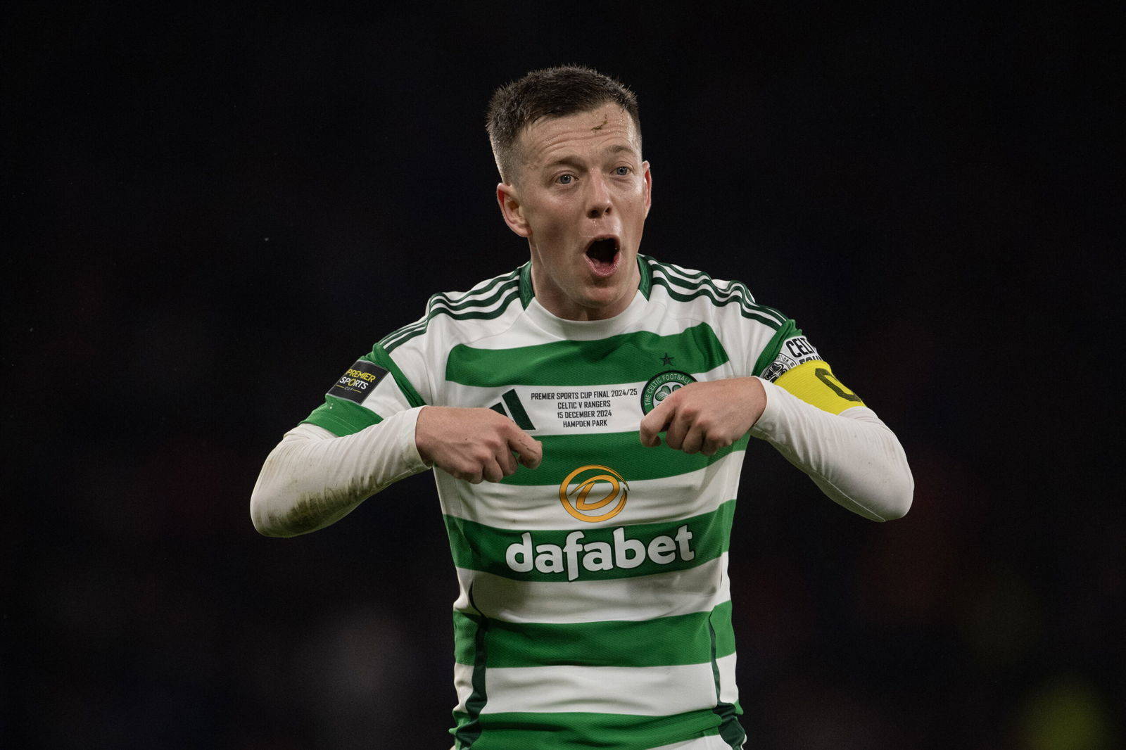 The Celtic manager and the captain know the standard. The rest have to meet it.