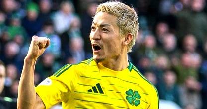 CELTIC v HIBS: 5-MINUTE QUIZ