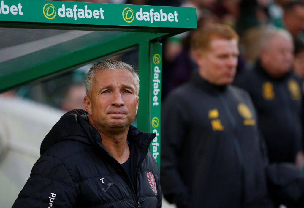 Celtic Transfer Target to Hold Crunch Talks
