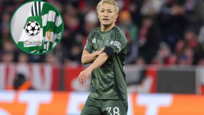 Every game Celtic will play before and after Champions League play-off fixtures