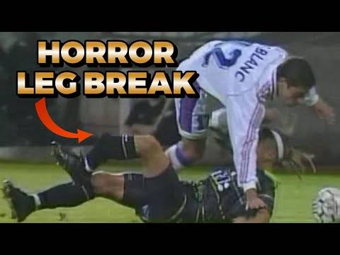 The WORST LEG BREAK in Football HISTORY!