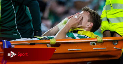 Celtic defender Alistair Johnston to miss 12 weeks with injury as Hoops trio doubtful for Livingston