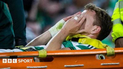 Celtic’s Johnston out ‘for about 12 weeks’