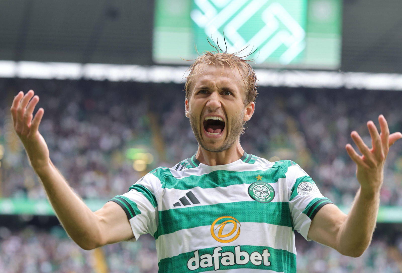 Celtic v Livingston Match Highlights: Hoops Reserves Smash Livi