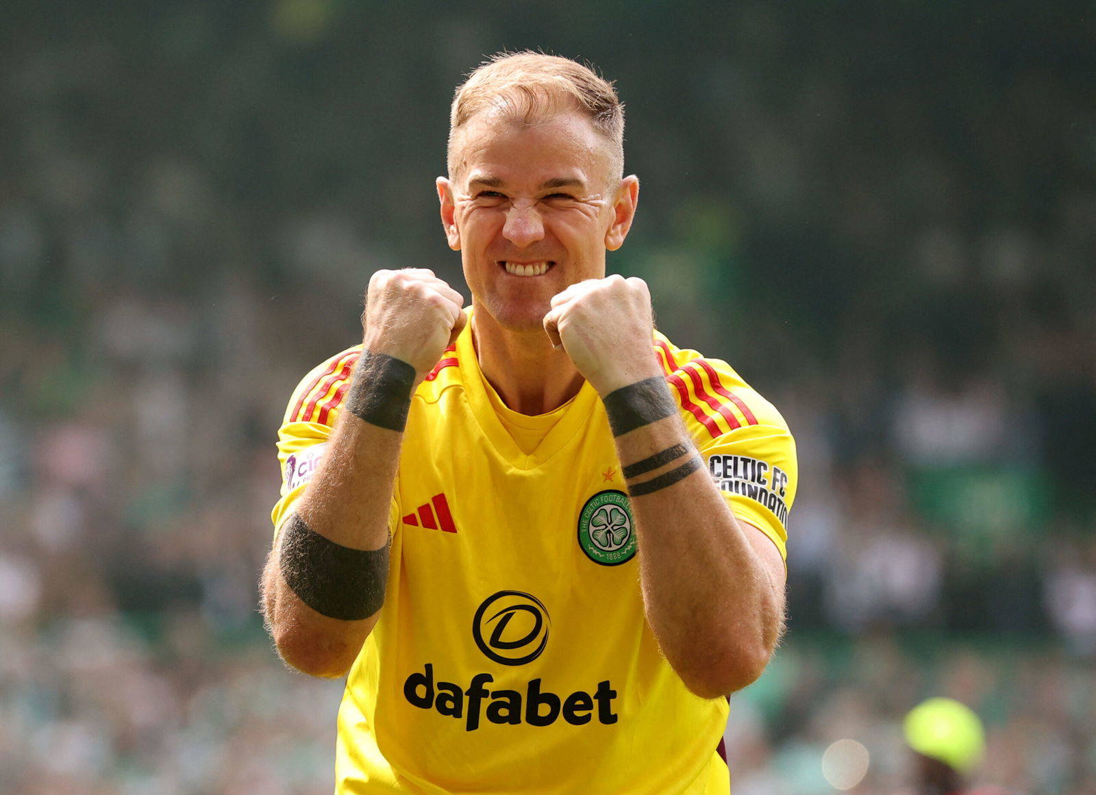 Watch the Celtic distress call from Joe Hart