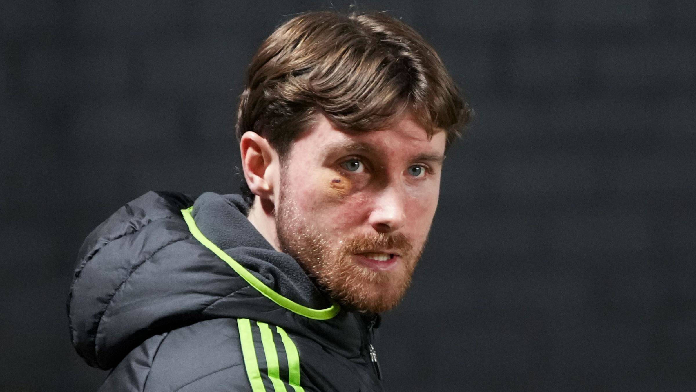 Anthony Ralston insists Celtic players back Wilfried Nancy ahead of Aberdeen test