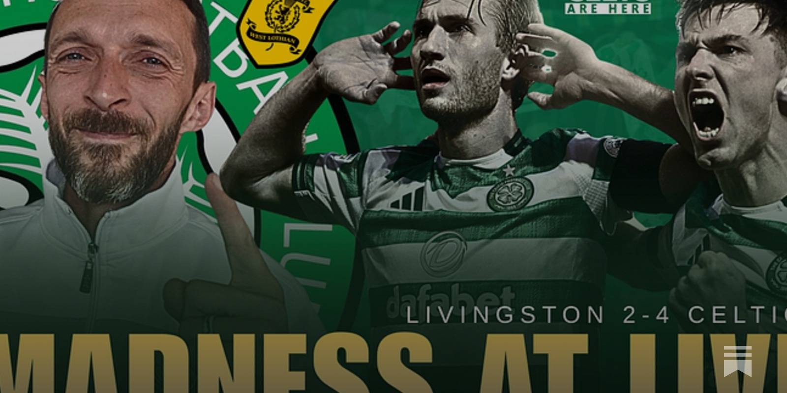 Wilfried Nancy’s Celtic System Decoded | The Reason They’re Winning