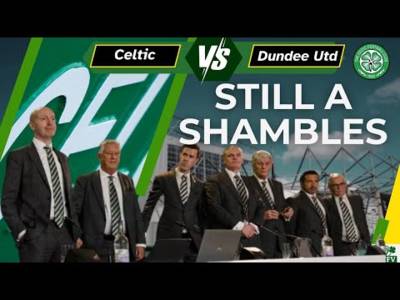 Celtic manager to STICK with Schmeichel Celtic manager to STICK with Schmeichel