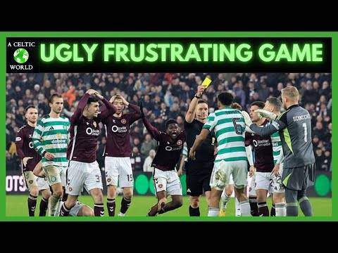 Percentage Football Dents Celtic Title Hopes