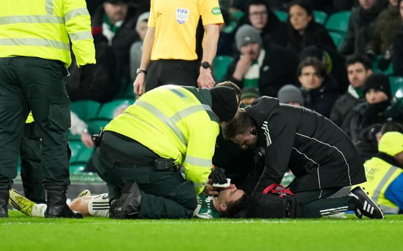 O’Neill on Kieran Tierney’s fitness and Oxlade-Chamberlain’s Celtic debut chances