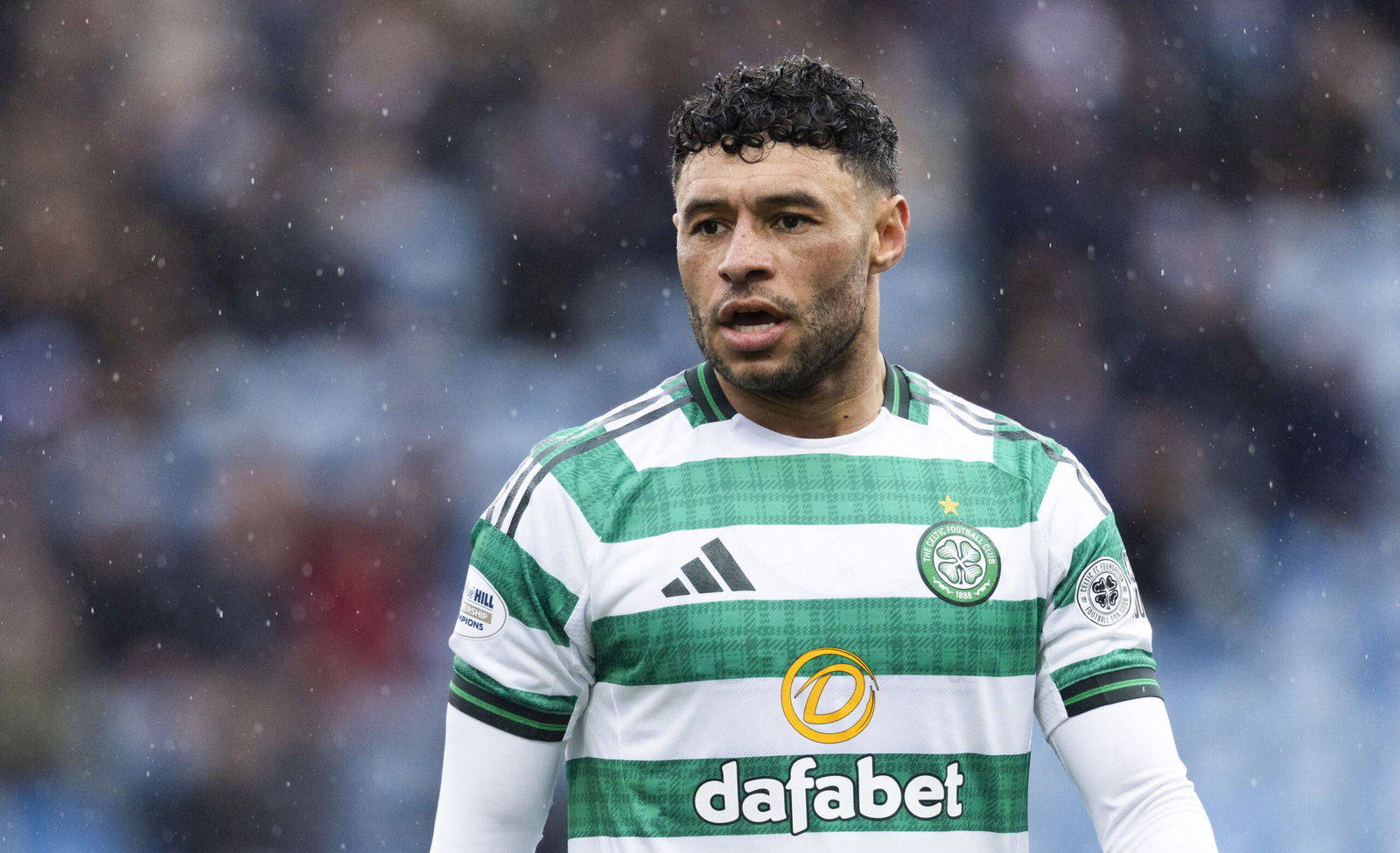 Alex Oxlade Chamberlain: Handle with care.