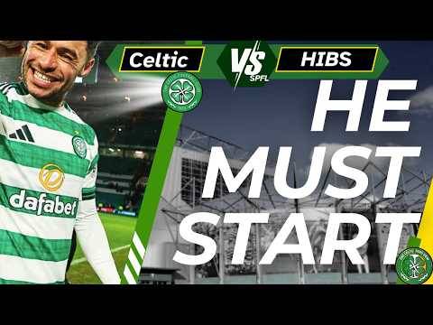 BIg game for Celtic and