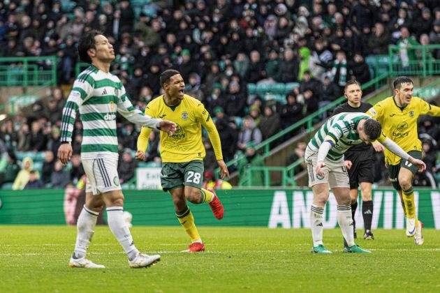 Celtic 1-2 Hibs – Disappointing defeat but somehow Hoops still in contention