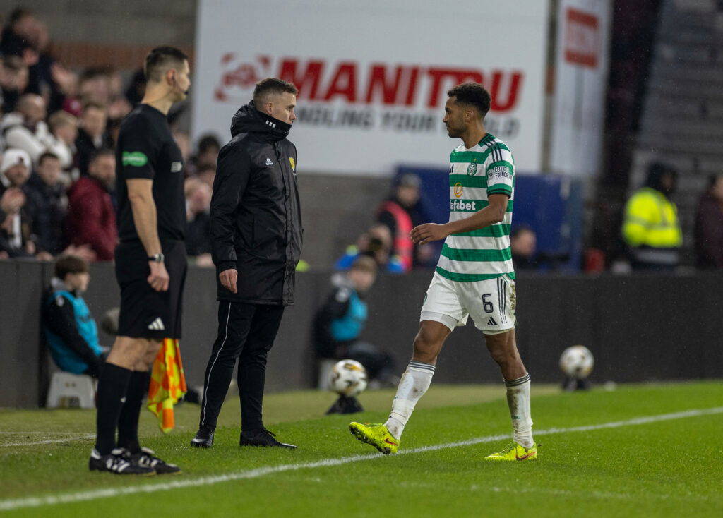 Celtic’s Auston Trusty Nightmare Scenario