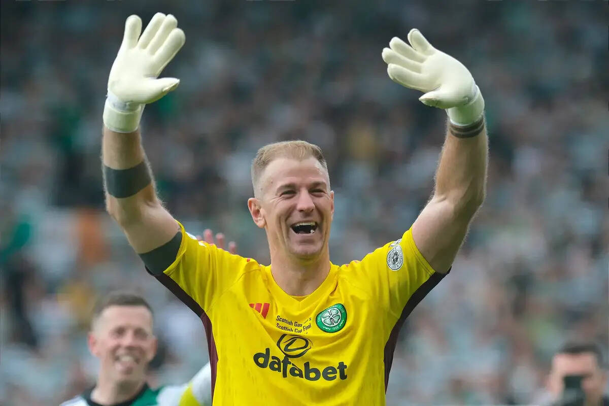 Joe Hart’s Tuesday Night Appearance Has Celtic Fans Talking