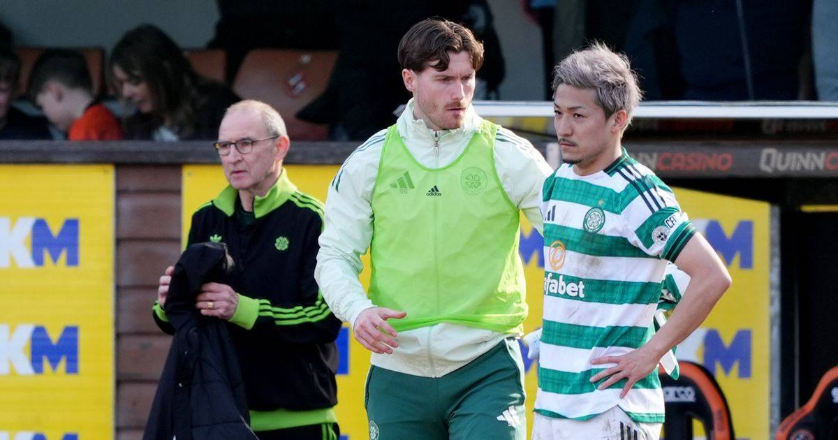 Celtic necessity for post split fixtures with Rangers and Hearts title fight dates and schedule clear