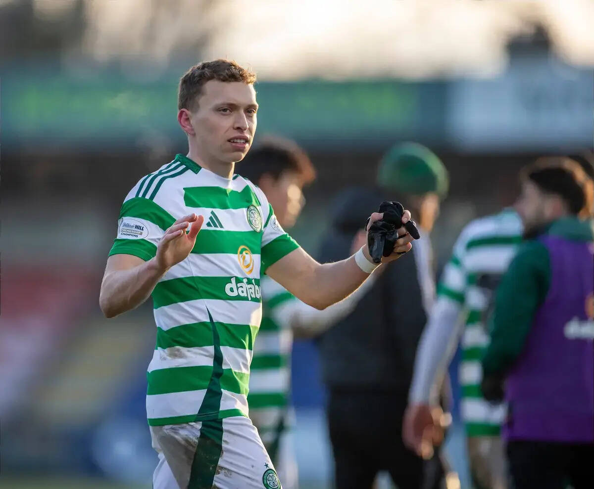 Celtic Star Steals The Show On TV Debut