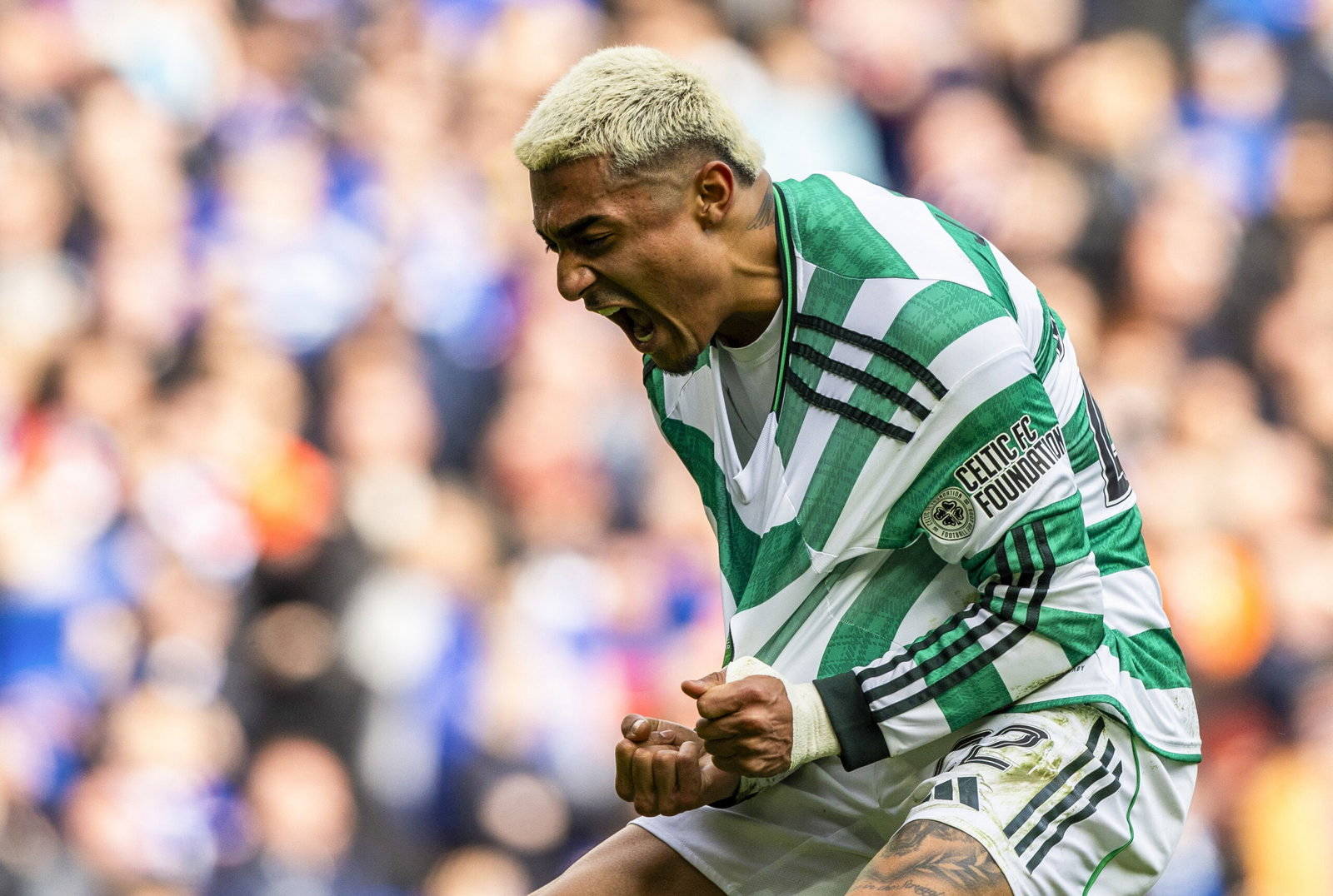 The Araujo injury adds to the sense that this Celtic season is cursed.
