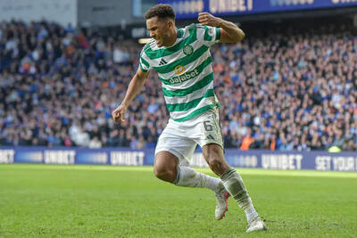 Celtic Star Drops Major World Cup Admission Celtic Star Drops Major World Cup Admission