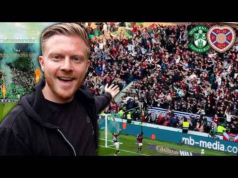 💥 The BIGGEST Edinburgh Derby EVER!