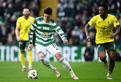 Trust this “ginger witch”; Celtic will beat Hibs on Sunday.