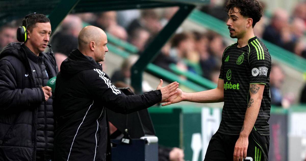 Celtic moment of ‘stupidity’ vs Hibs placed under microscope
