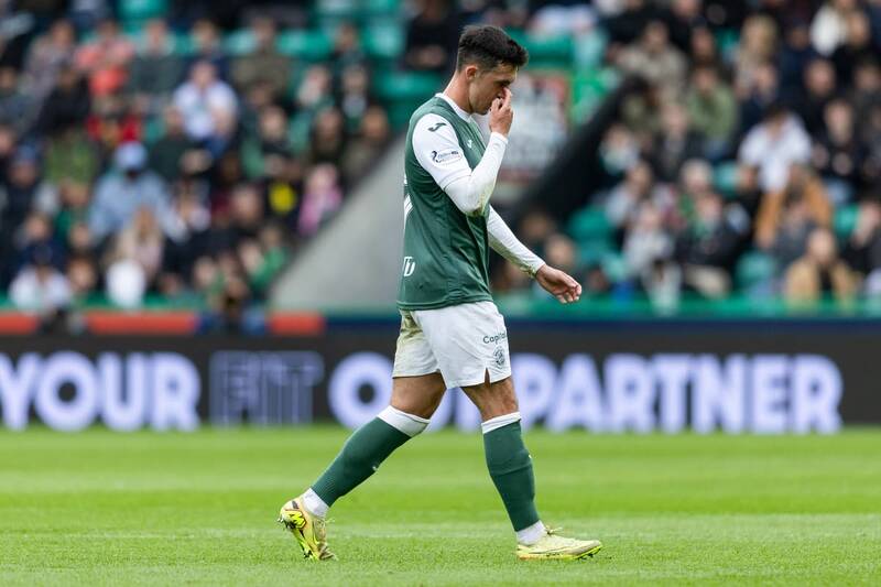 ‘I can’t defend that’ &ndash; Hibs boss red card reaction as Celtic loss deals hammer blow to Euro hopes
