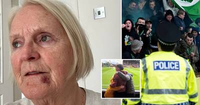 Gran punched by thug Celtic fan scared to attend games as cops launch probe