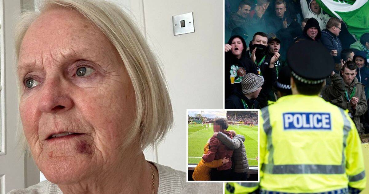 Gran punched by thug Celtic fan scared to attend games as cops launch probe