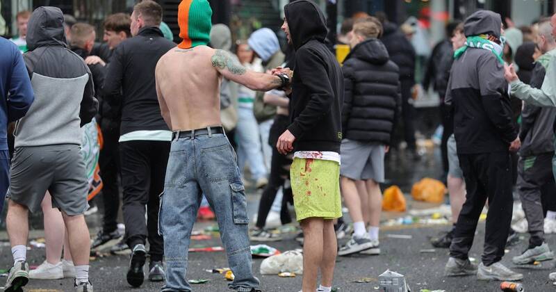 Police demand crunch talks as cops injured in Celtic title party and Hearts players ‘assault’ probed