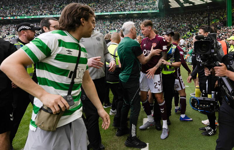 Keith Jackson pours petrol on the flames with his “Operation A*** Covering” article, and his claims of Frankie Kent being “blood spattered” at Celtic Park