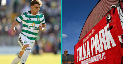Shelbourne v Celtic At Tolka Park: All You Need To Know About Dublin Friendly