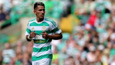 Celtic vs AC Milan: Pre-season preview, prediction & lineups Celtic vs AC Milan: Pre-season preview, prediction & lineups