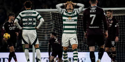Why Celtic Struggle Against Low Blocks Why Celtic Struggle Against Low Blocks