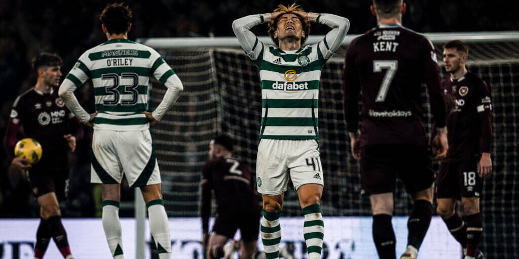 Why Celtic Struggle Against Low Blocks