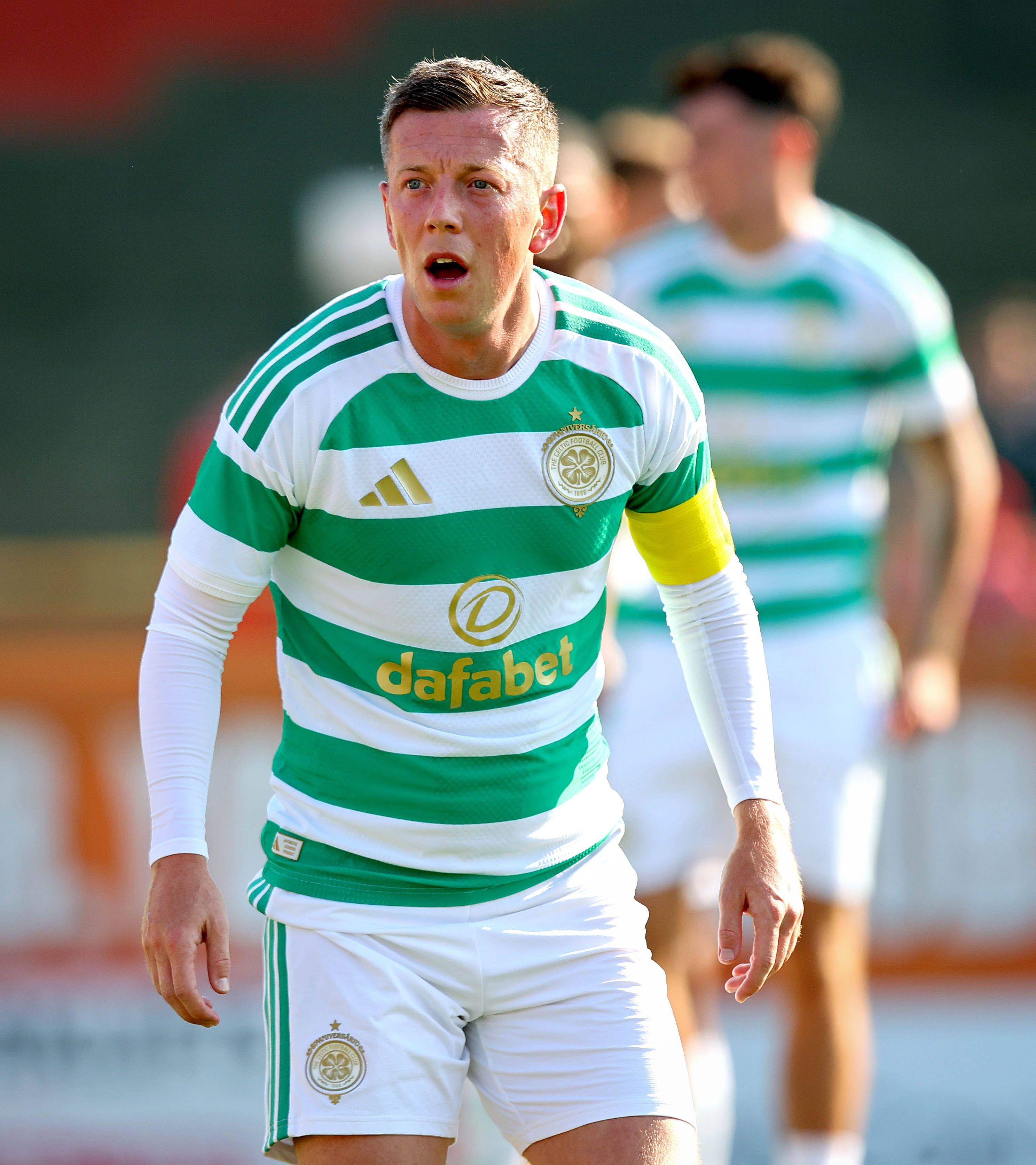 CELTIC STORIES: Hungry like the Hoops – Duran Duran