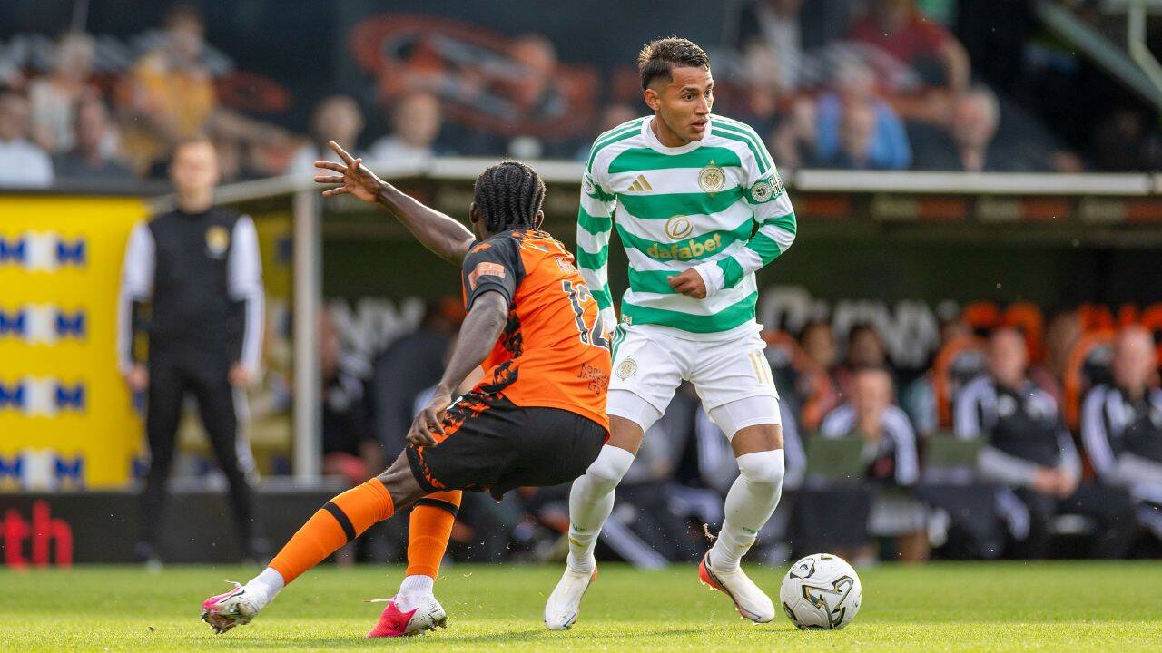 Celtic’s Biggest Change Might Not Be The New Signings