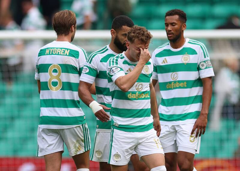 Major Celtic injury concern as Callum Osmand picture surfaces