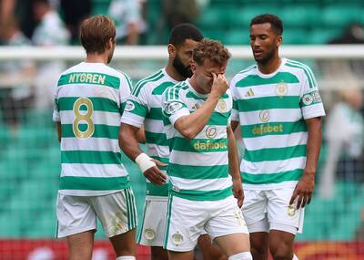 Major Celtic injury concern as Callum Osmand picture surfaces Major Celtic injury concern as Callum Osmand picture surfaces