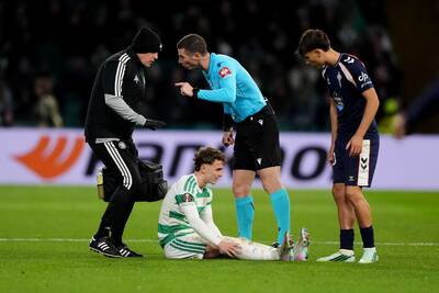 Callum Osmand Celtic Injury Update Callum Osmand Celtic Injury Update
